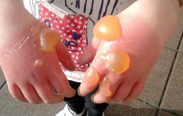 Afbeelding bij Berenklauw opgepast